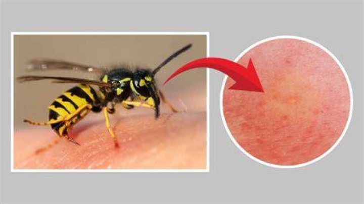 Can Wood Wasps sting?