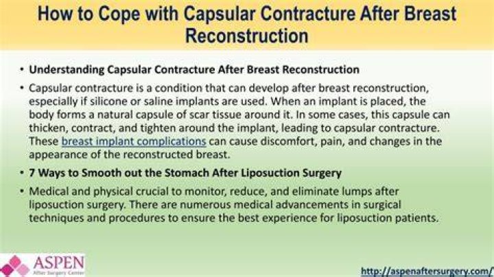 Can you fix capsular contracture without surgery?