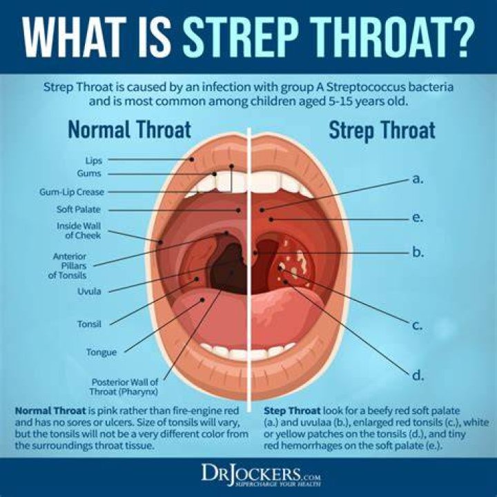 What does it mean when you have strep in your blood?